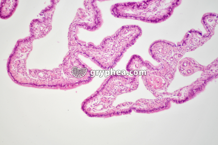 Trompe de Fallope x40 - gryphea.com